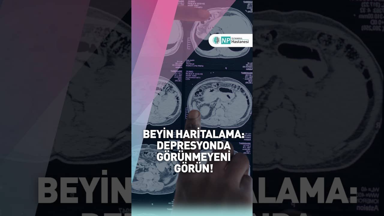 🧠 Depresyon beynin tek bir noktasında mı ortaya çıkıyor?