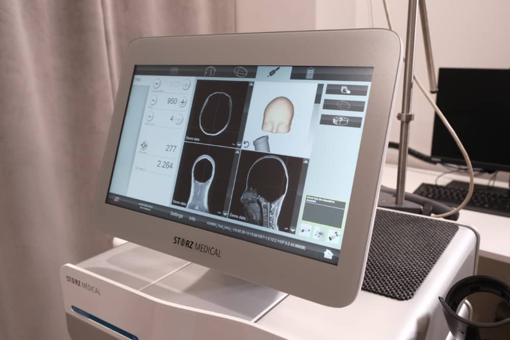 Elektromiyografi (EMG) Nedir? EMG Nasıl Çekilir?